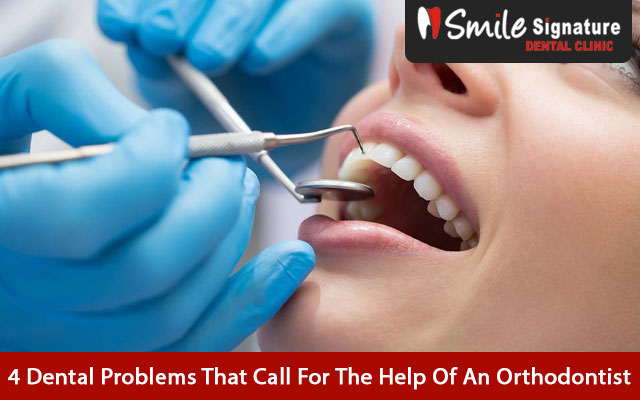 4 Dental Problems That Call For The Help Of An Orthodontist