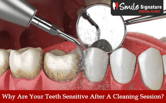 Why Are Your Teeth Sensitive After A Cleaning Session?