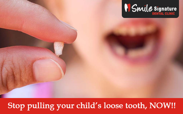 Stop pulling your child’s loose tooth, NOW!!